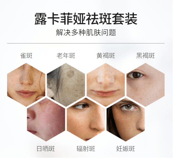 小资女性的福音淡斑效果好的护肤品