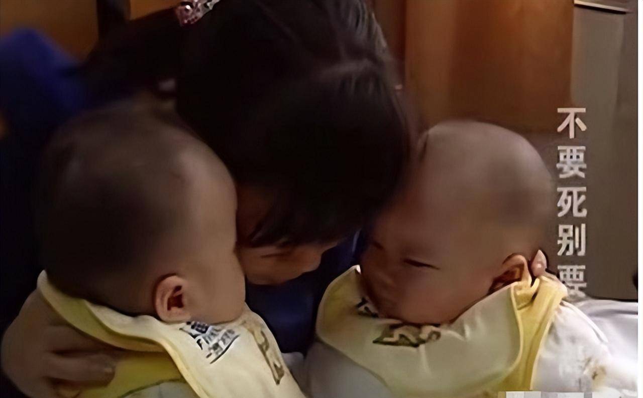 连体婴儿距离动手术还有一段的时间,医生,杨伟和张建军夫妇包括两个