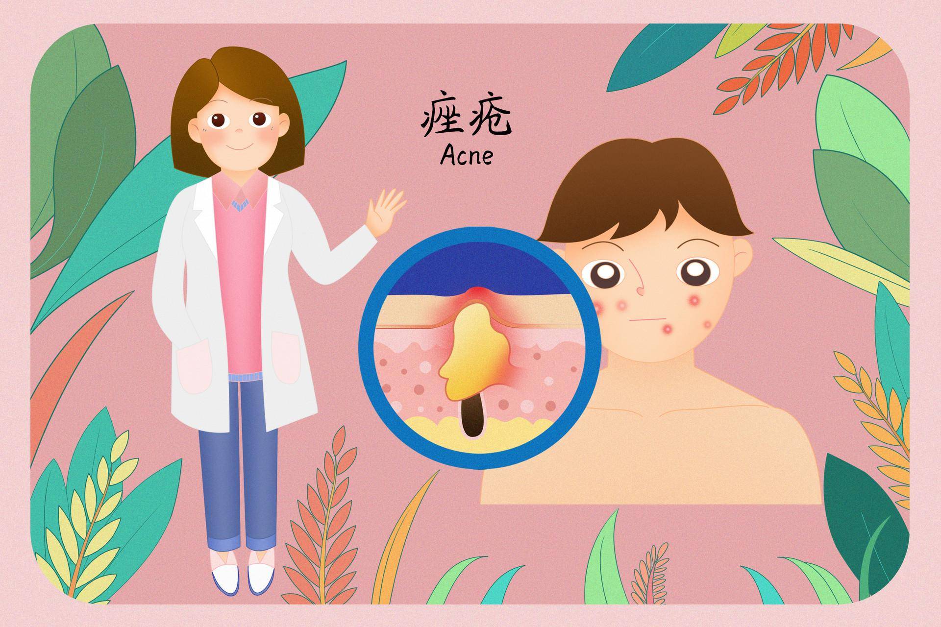 可能是痤疮在作怪!日常改变这些生活方式!