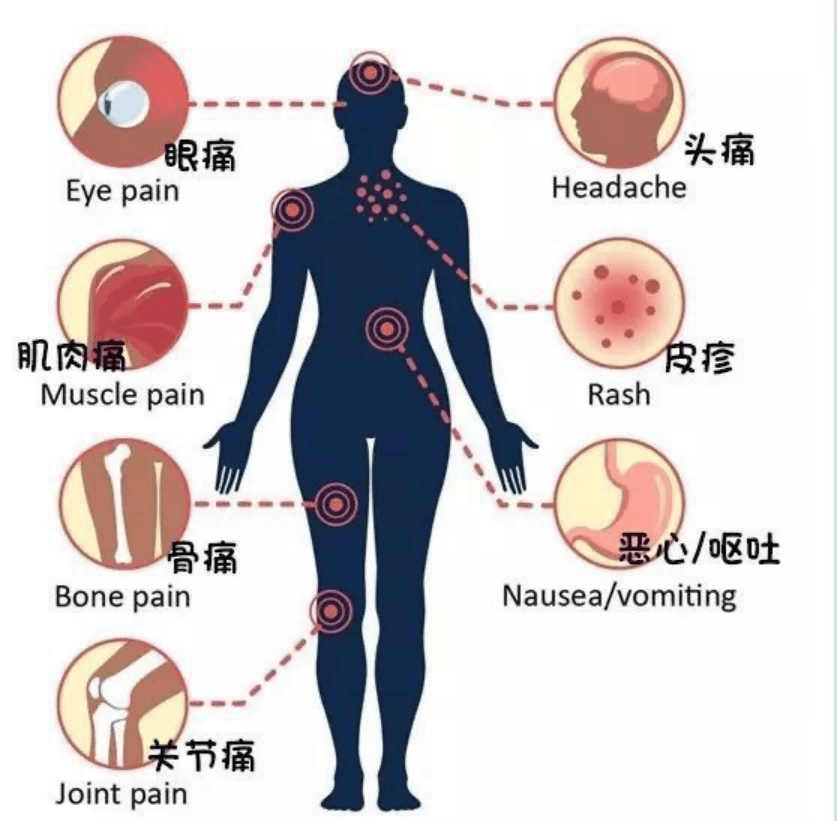 高烧,头痛,面红,多国疫情上升,全面防控这样做