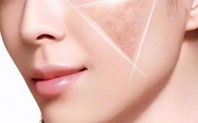 嘴唇发黑人体肝功能出现异常时,不仅降低机体的肝脏功能,还会促进机体