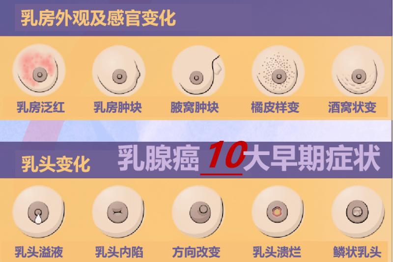 乳腺癌分泌物照片图片