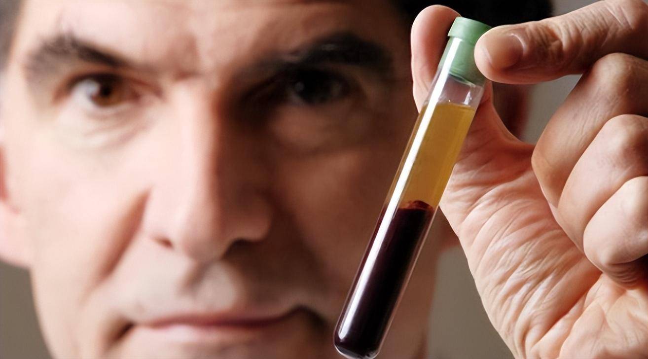 原创美国亿万富翁为重返18岁花千万保养拿17岁儿子血浆全身换血