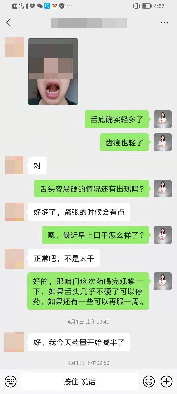 问止中医陈帅医师舌头僵硬又爱出汗怎么回事