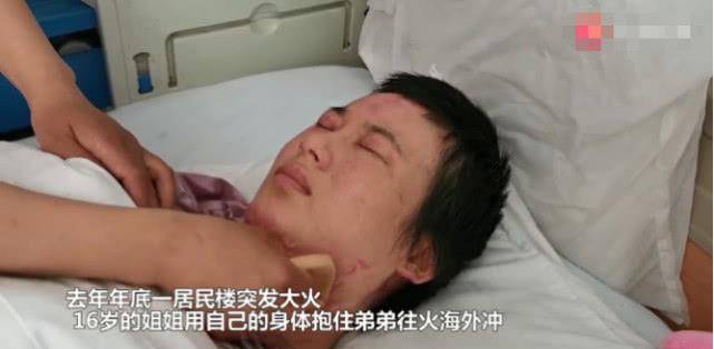 原创2019年一16岁少女火海救弟弟被毁容弟弟没人要你我娶你