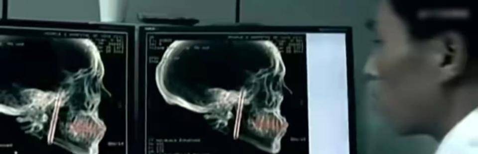 原创11年云南男子口臭骇人医生检查后大惊失色脑中插着一把匕首