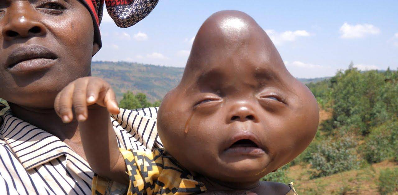 有些孩子甚至还会生出畸形的头颅和器官.