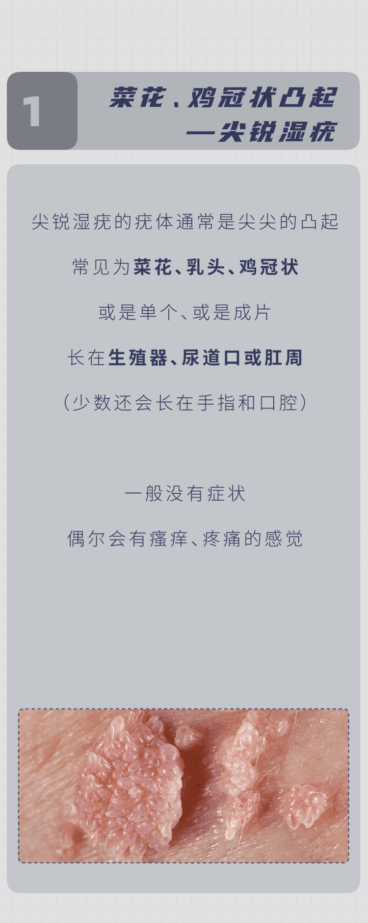 原创怎么在性生活前判断伴侣有没有性病5个检查男女都该清楚