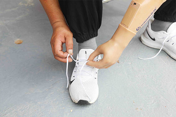 上臂假肢要怎么佩戴才舒服