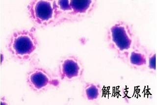 人型支原体和解脲支原体感染的区别究竟有哪些