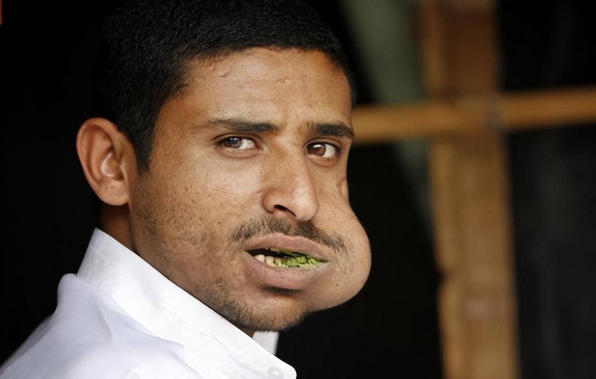 阿联酋等国相比较,故而其他阿拉伯国家在禁止恰特草的时候,也门当局