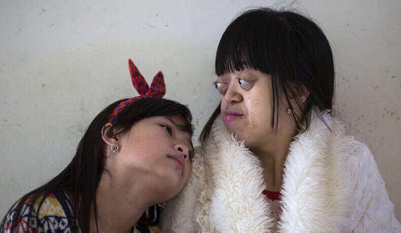 这是一种除草剂越战时美军用在了越南人身上恶果如今开始显现