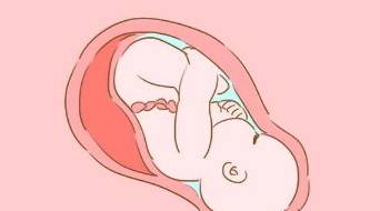怀孕后孕妈肚脐凸出来,真的预示要生男孩吗?