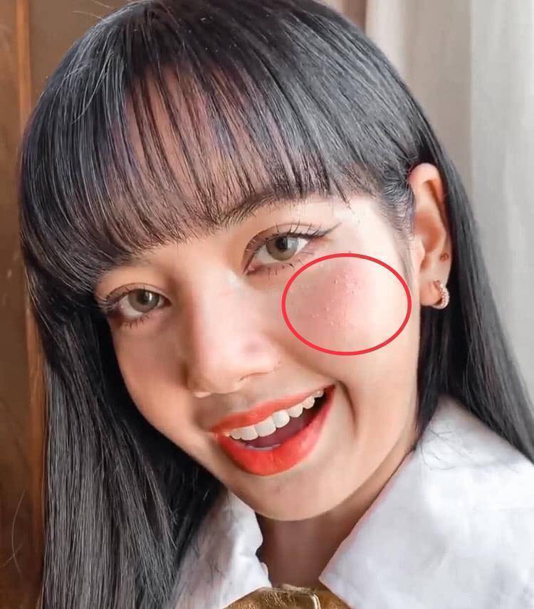 原创lisa怼脸照关掉美颜后五官粗糙脂肪粒扎堆真人芭比形象翻车