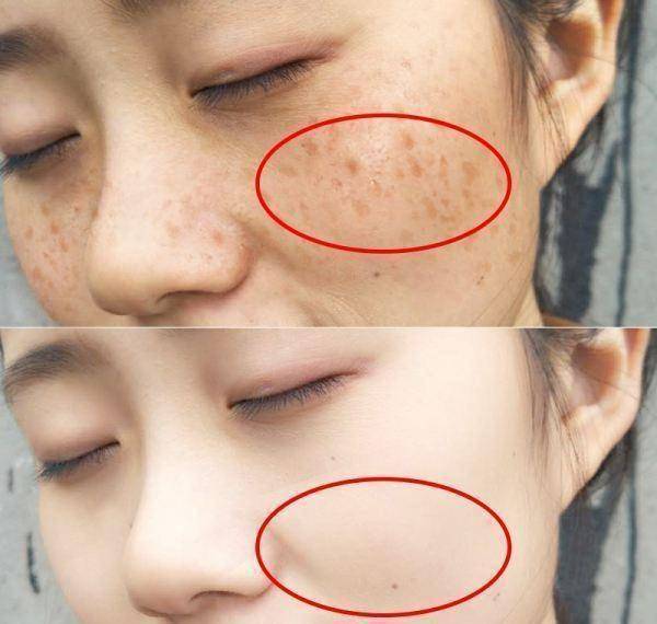 分享美白干货淡斑效果好的护肤品