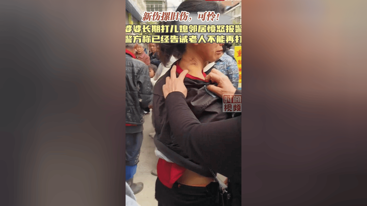 婆婆将儿媳打得满身疤痕 邻居报警 暴力事件引众怒_受害者_相关_社会