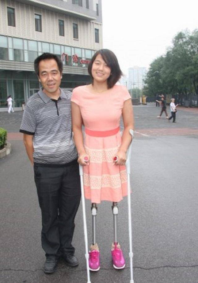 原创还记得篮球女孩吗靠半截身躯获游泳冠军如今装上假肢亭亭玉立