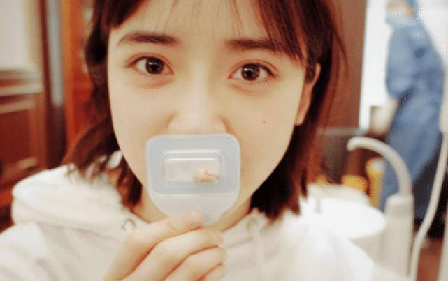 原创沈月拔智齿第二天直接脸肿晒敷冰块照片太真实了