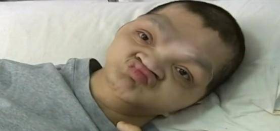 2007年,湖南小伙长相怪异如"猴人",爬行树林间智力仅2岁_陈聪_华的