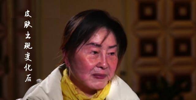 原创17年前那位妙龄少女一夜变成老奶奶如今现状如何