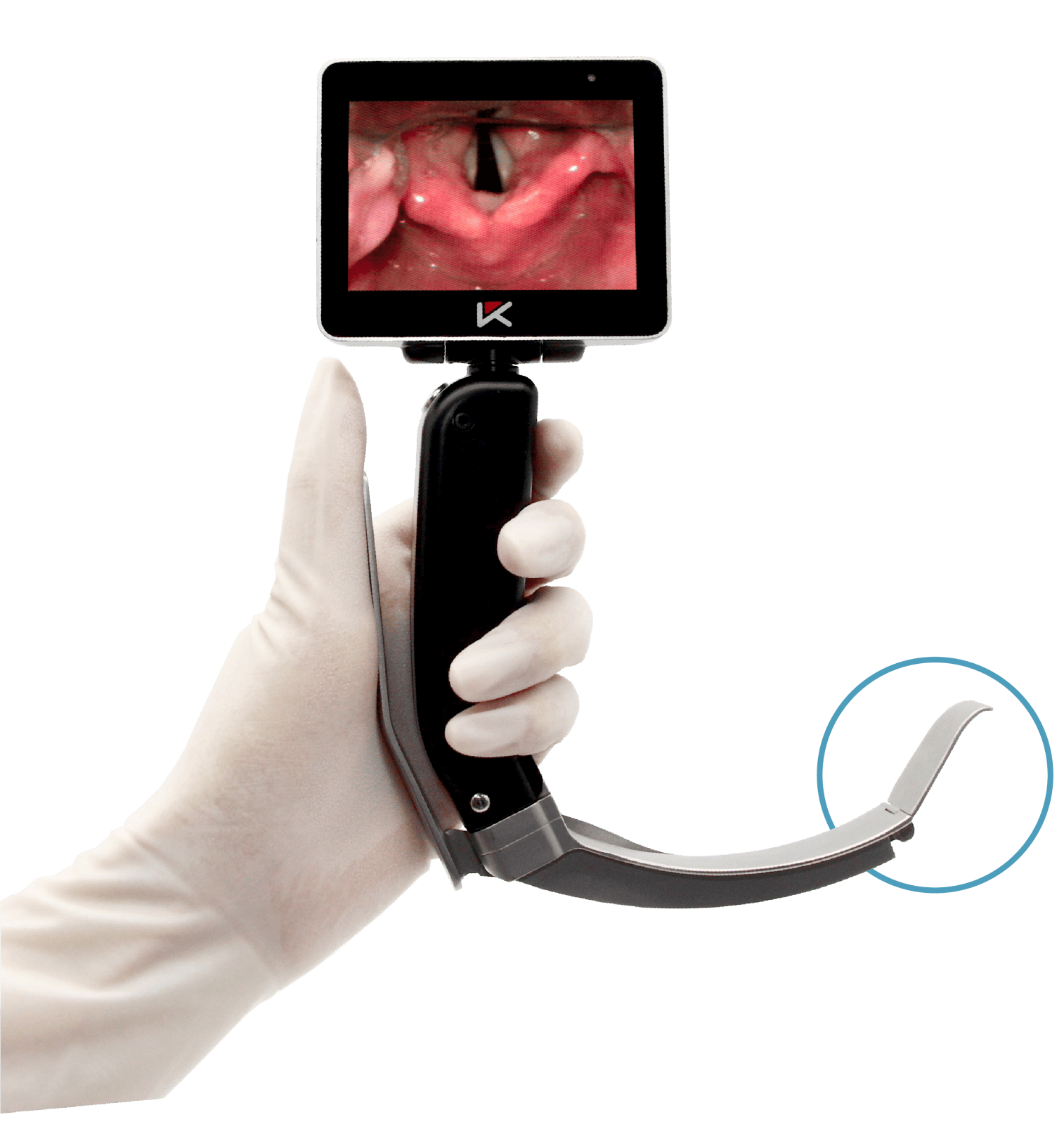 从盲探到直视:可视喉镜在气道管理中的应用进展