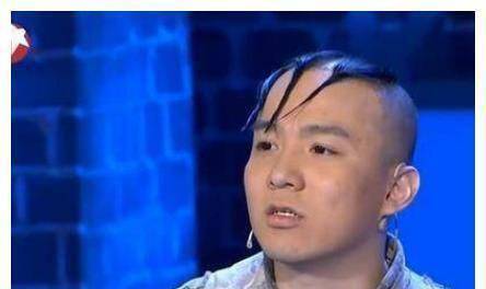 原创原创34岁三毛变帅哥8岁成名14岁秃顶植发挨300多针