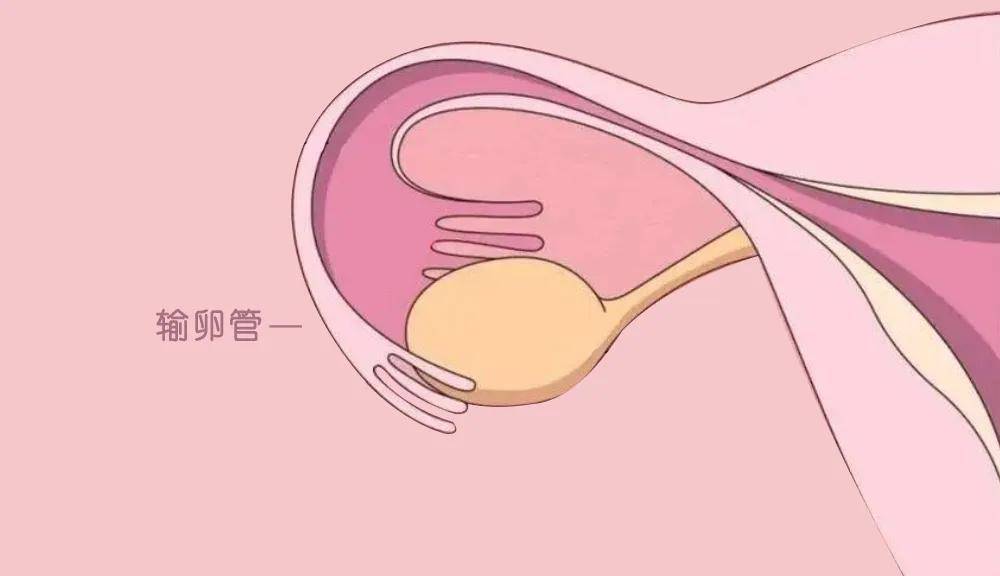 [上海红睦房中城医院]宫外孕切了一条输卵管,2种方法帮你提高怀孕率