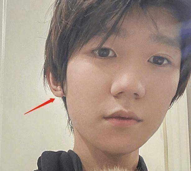 原创出国留学后的王源很少发自拍表情略显憔悴像个19岁的阳光少年