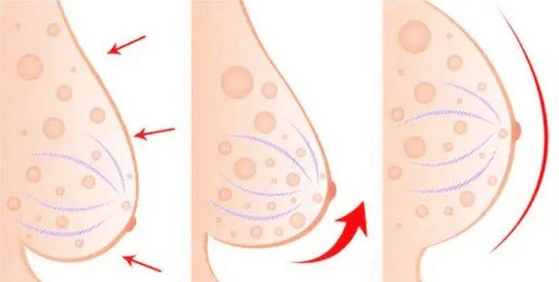 大乳房 正常 起来图片