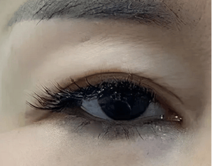 揭秘来了!_皮肤_眼袋_眼睑