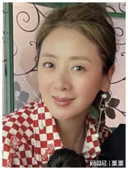 杜淳老婆被烫伤后续第二天就开始带货伤痕明显回应网友