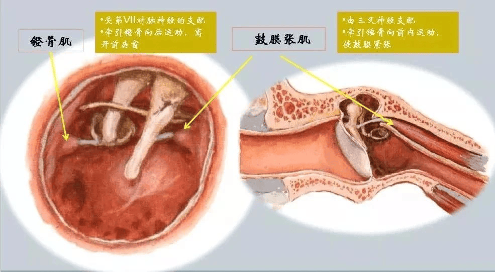 中枢判断声音过大,于是下达指令让位于中耳的镫骨肌发生收缩,牵拉镫骨