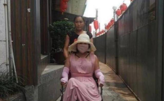 原创整容狂人红粉宝宝花400万换脸200次今坐轮椅悔不当初