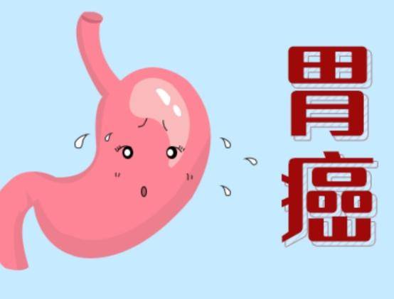 胃癌不痛不痒医生提醒饭后如果存在4个表现建议尽早做胃镜