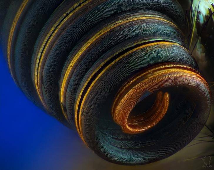 第十八张:自行车选手珍妮丝·布拉科维奇在比赛结束以后腿部的状态.