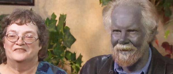 世界罕有的蓝种人血液呈蓝色隐居在6千米高山几乎与世隔绝