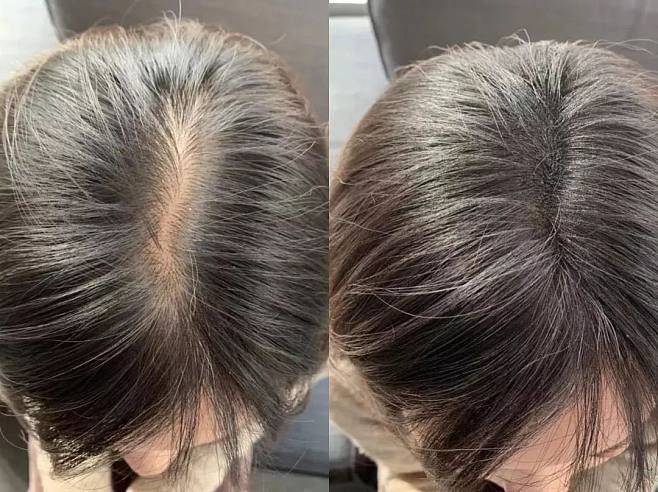 测评:生发防脱发洗发水什么牌子好,防脱好物合集_头皮_头发_发丝