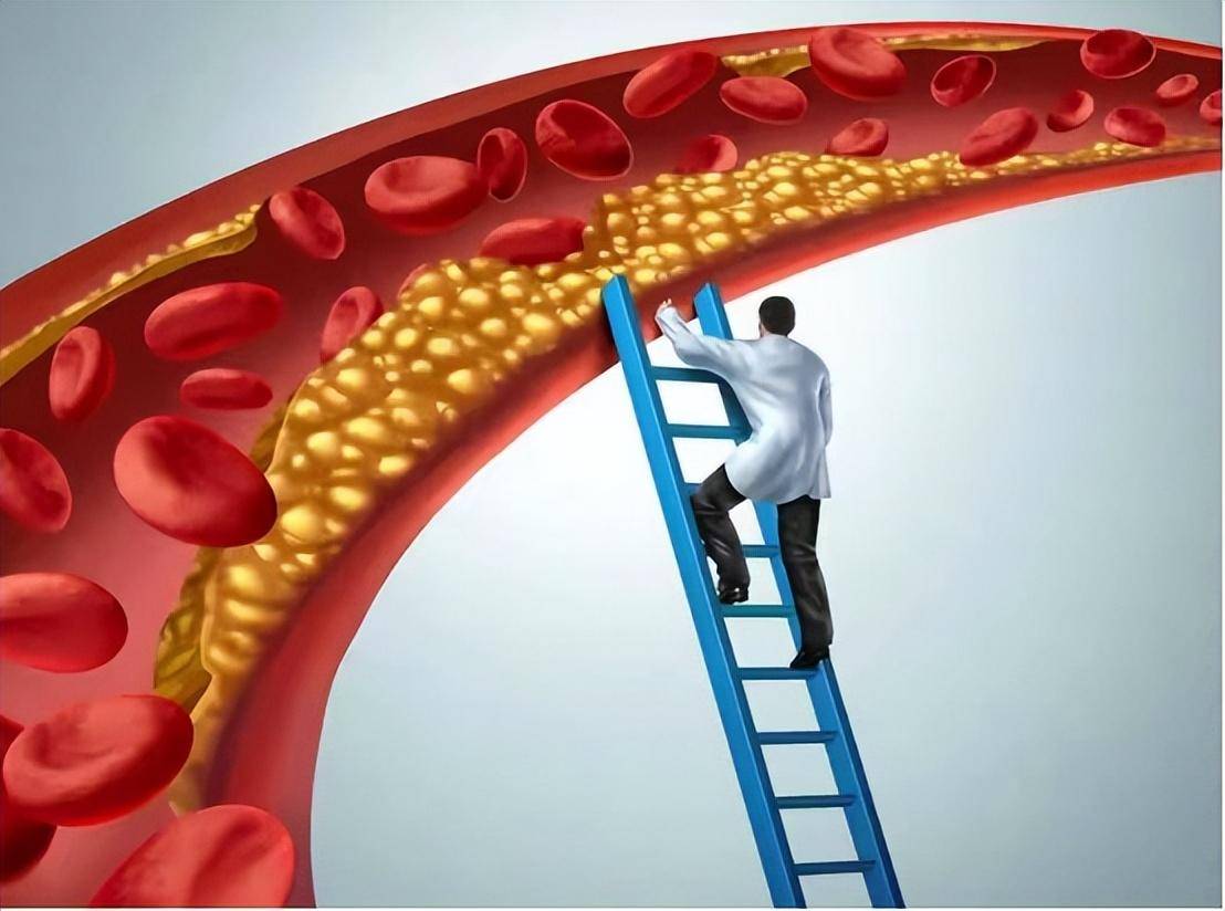 为什么现在脑梗越来越多?医生提醒:饭后少做4件事,能改则改_疾病_心脑