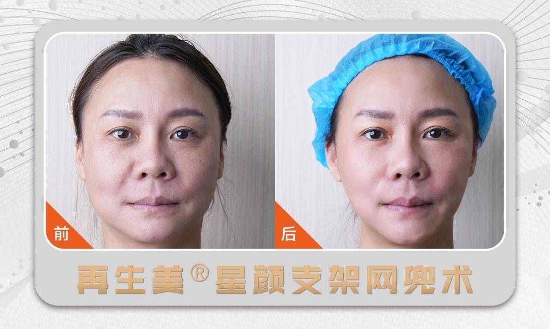 九院轻医美张文博:创造美丽新篇章,卓越才能点亮梦想之貌