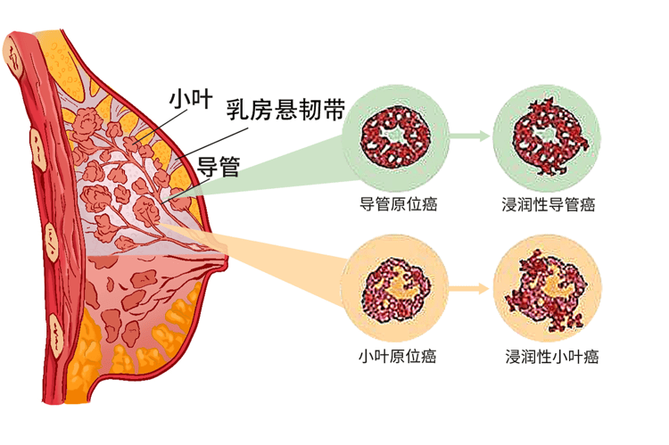 乳房大的女性