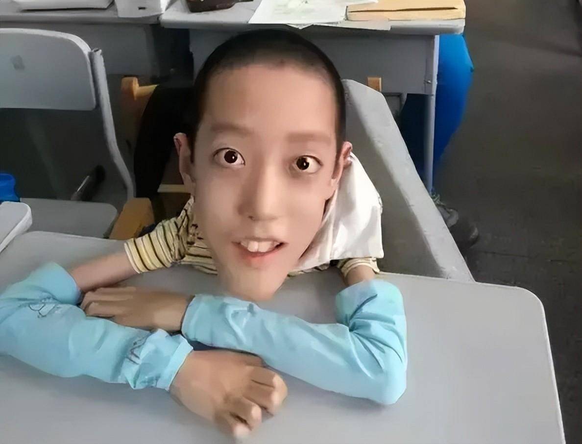 2021年,仅18公斤渐冻症男孩邢益凡,被北航录取,如今怎样了?