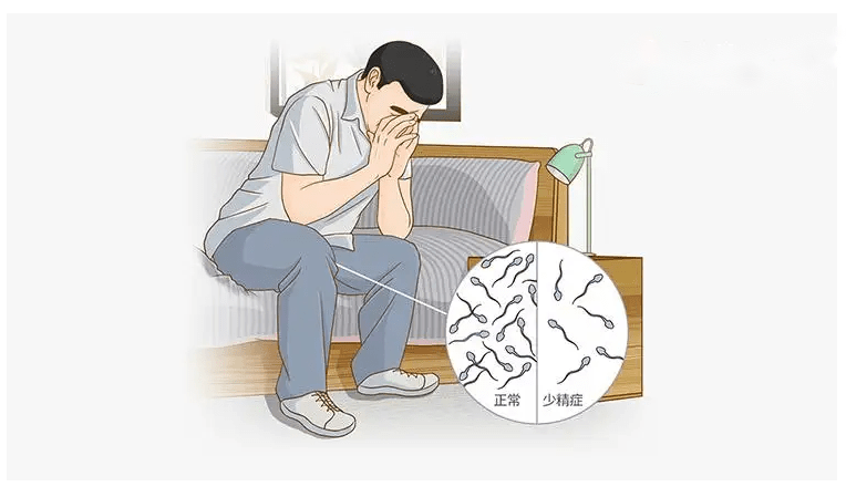 一般把蝌蚪活动力分为四个等级:弱精症是造成男性不育的