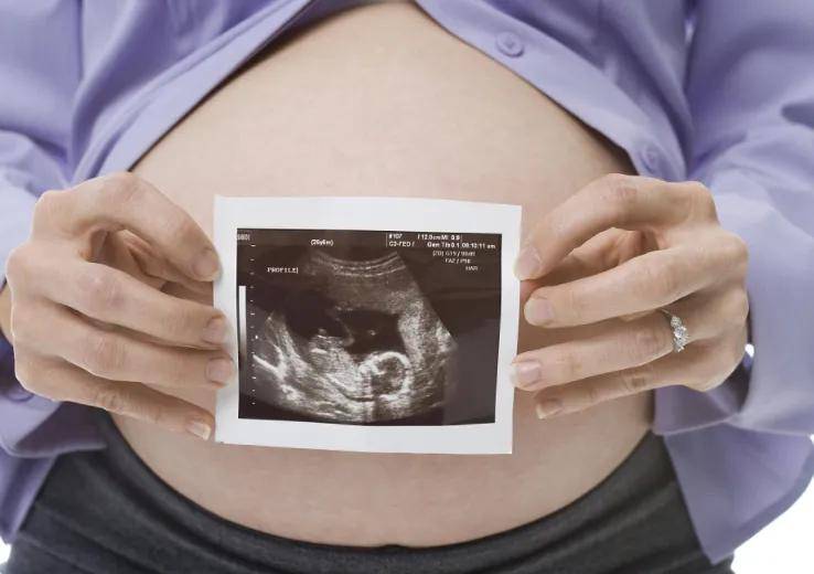 如果在孕期检查时有这四种“现象”，可能更有可能生下“小王子”_ baby _ boy _胎儿。