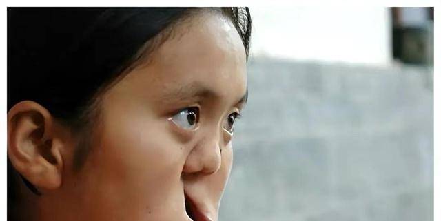陕西农民捡到坑面女婴,为帮养女整容送走儿子,变美后她嫁给哥哥