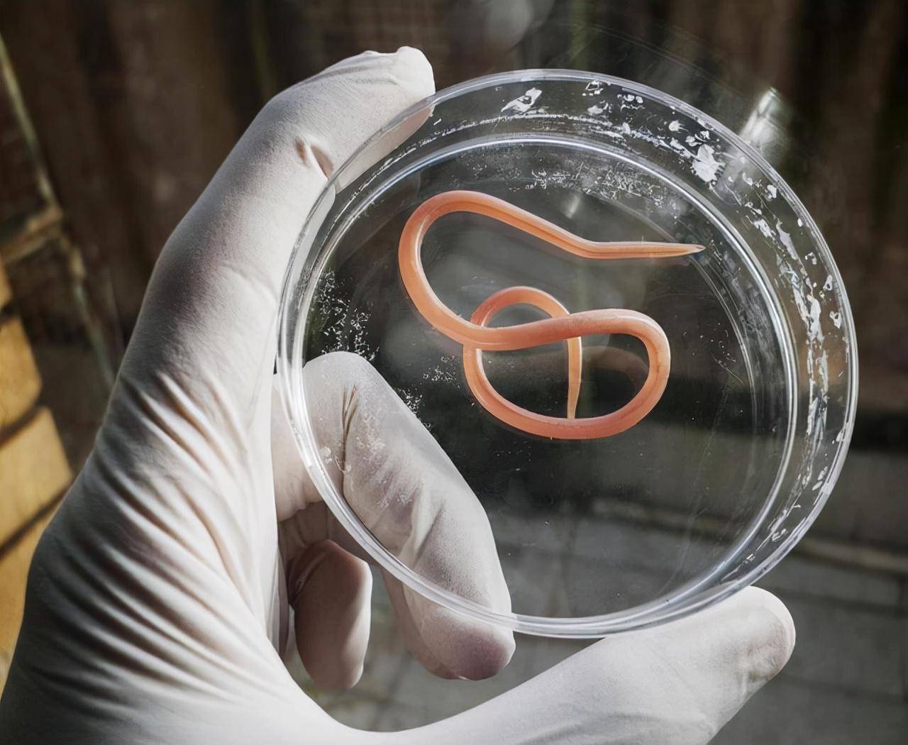 腐蚀液体洗脸,活吞寄生虫,服用砒霜,英国女性为了美有多疯狂?