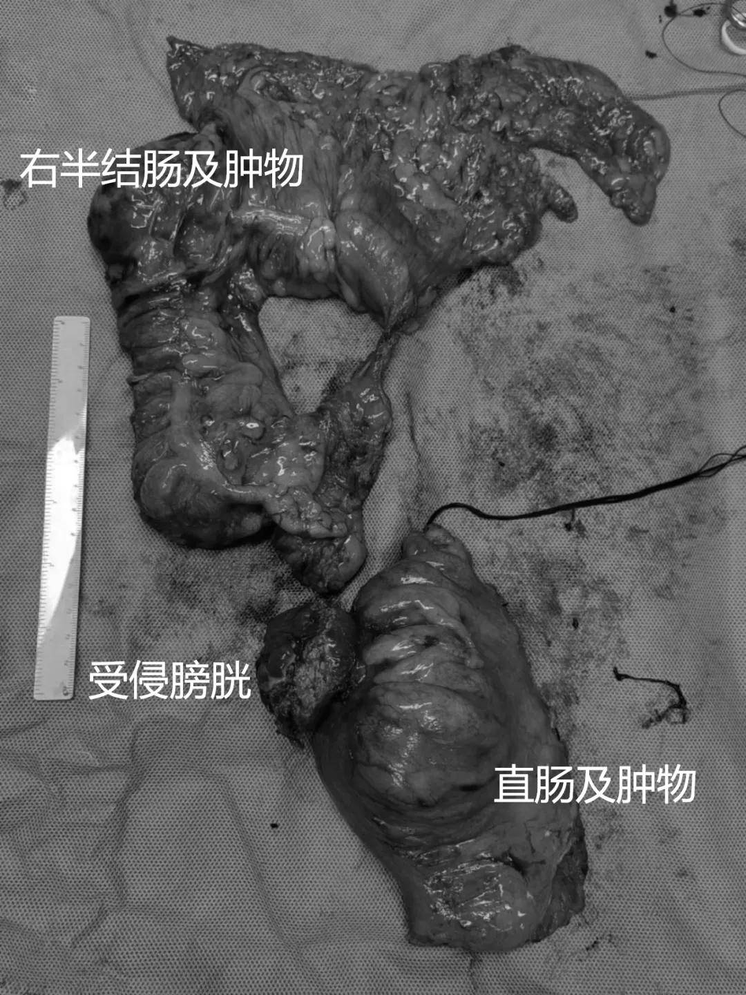 膀胱_先生_团队
