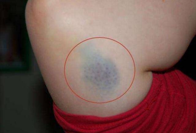 白血病根源跟哪些食物有关?医生:冰箱里这3物,别给孩子吃了