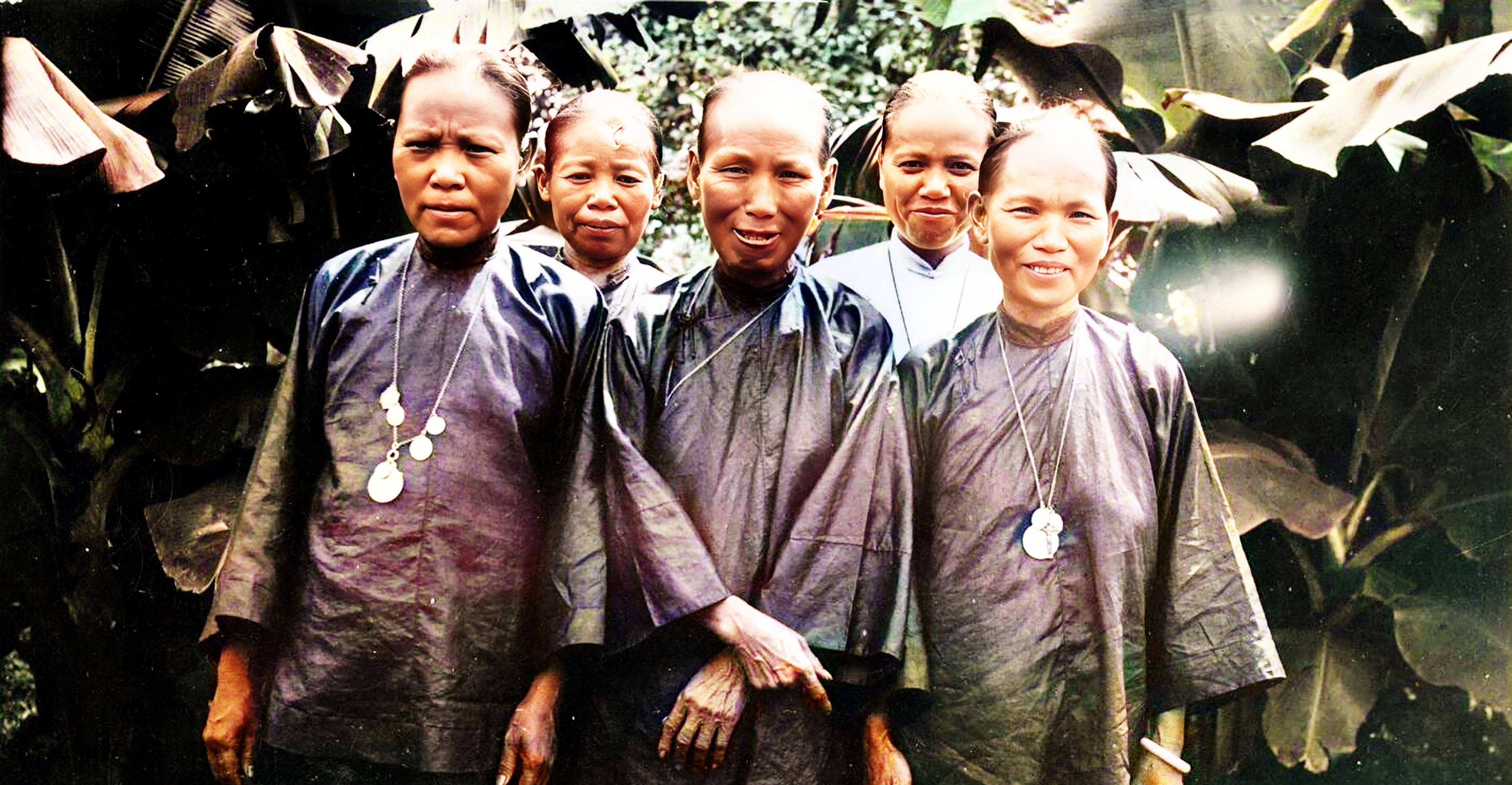 1935年的广东罗定,文塔顶长着两棵小树,妇人遇土匪留下恐怖伤疤