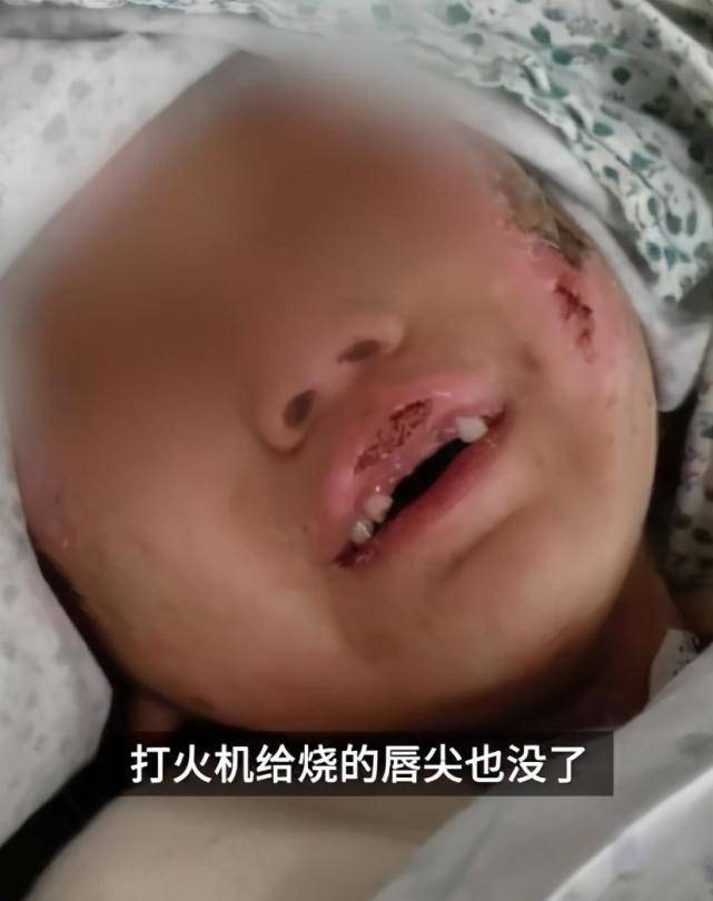 姥姥表示,事后童童还告诉她:自己的牙齿曾被陈某威