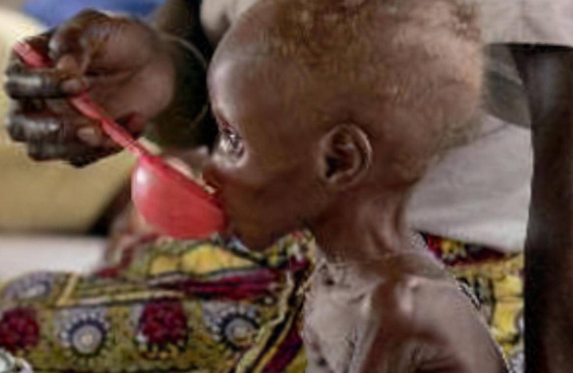 28年前,凯文拍下非洲女孩饥饿照传遍世界,后为此付出了生命代价